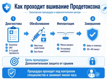 Имплантация Продетоксон в Донском